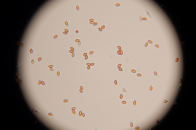 Messa a punto del microscopio